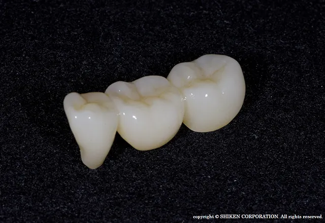 当院の予防治療