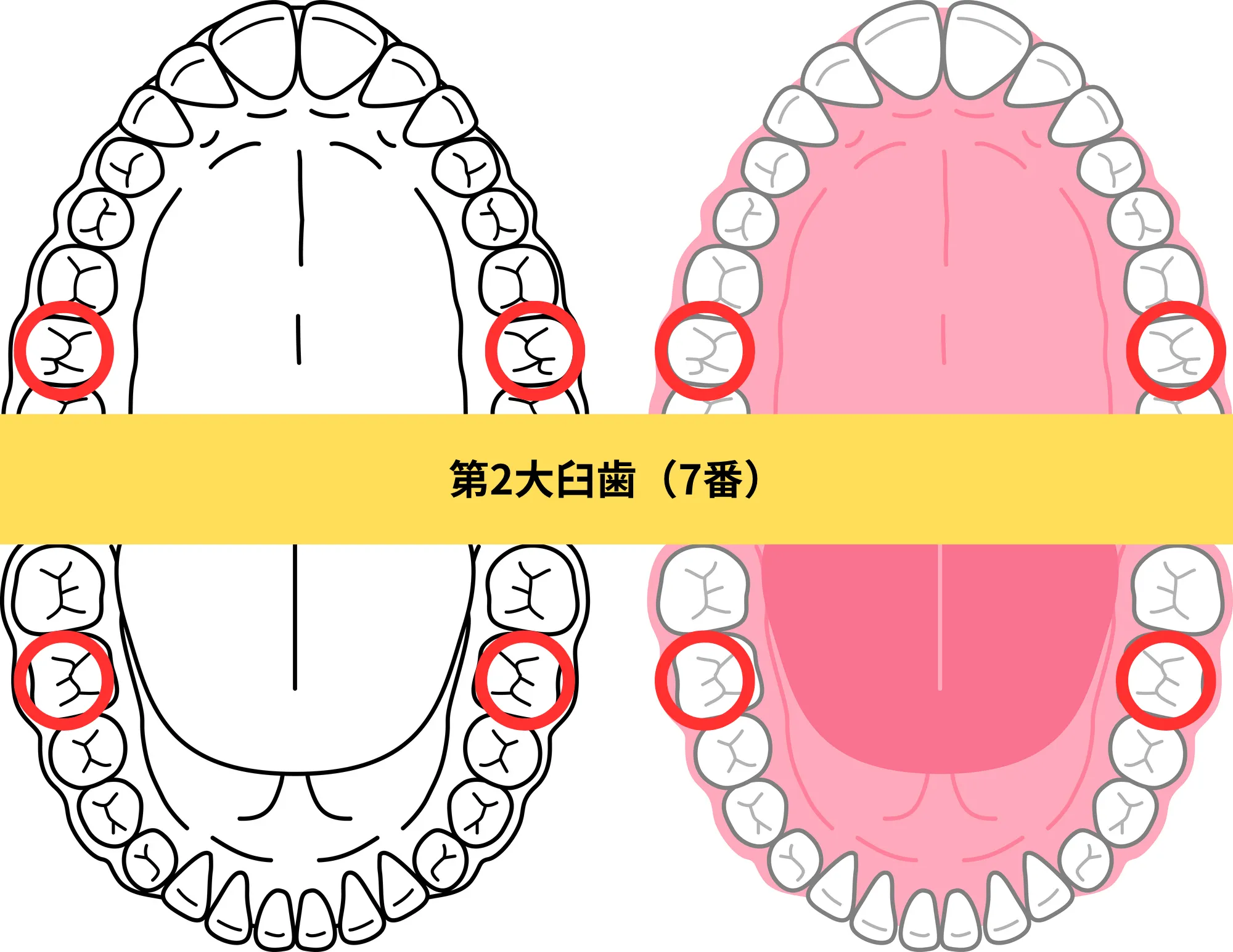 前歯（1〜3番）のイメージ