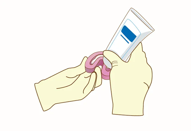 むし歯にさせないための治療