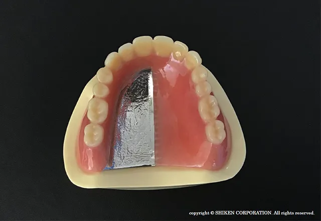 当院の予防治療