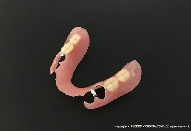 当院の予防治療